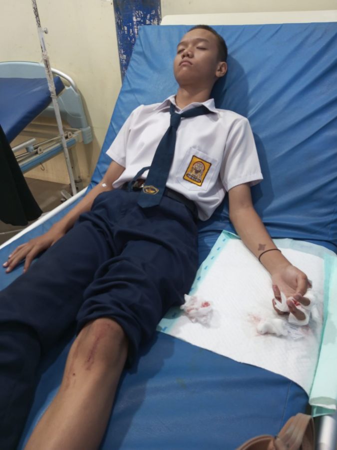 Kepala SMPN 6 Siak Hulu Diminta Bantu Penuh Biaya Perobatan Siswanya